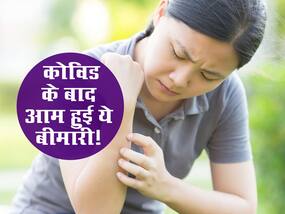 कोविड से ठीक होने के बाद क्या आम बन गई हैं ऑटो-इम्यून डिजीज? स्टडी में दावा इन लोगों को हो रही ज्यादा परेशानी