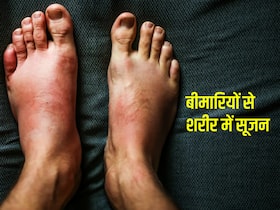 इन बीमारियों से शरीर पर आती है सूजन, जानें लक्षण