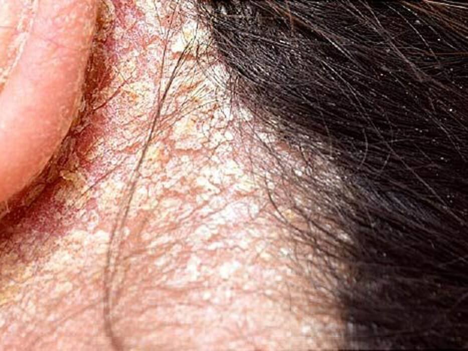 बालों से जुड़ी इन 3 समस्याओं को खत्म कर देगा काली मिर्च का तेल, जानें कैसे बनाएं और इस्तेमाल का तरीका