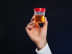 Blood in Urine: рдкреЗрд╢рд╛рдм рдореЗрдВ рдЦреВрди рдЖрдП рддреЛ рд╣реЛ рдЬрд╛рдПрдВ рд╕рд╛рд╡рдзрд╛рди, рдЗрди 9 рдЧрдВрднреАрд░ рдмреАрдорд╛рд░рд┐рдпреЛрдВ рдХреЗ рд╣реЛ рд╕рдХрддреЗ рд╣реИрдВ рд╕рдВрдХреЗрдд