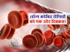 लॉन्ग कोविड के शिकार लोगों के खून में हो रही गड़बड़ियां! वैज्ञानिकों ने बताया कौन से रोगी सबसे ज्यादा परेशान
