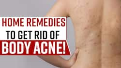 Body Acne Remedies: Suffering From Body Acne Try These Home Remedies, Watch Video