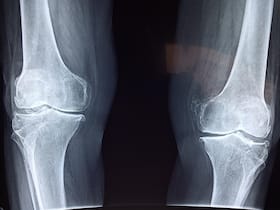 5 Drinks That Serve As An Anti Aging Agent For Your Bones