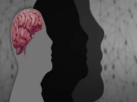 6 Brain Boosting Nutritious Rich Foods For You