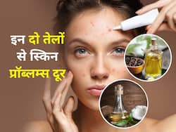 नारियल के तेल में इस 1 चीज को मिलाकर लगाने से दूर होंगी ये 4 स्किन प्रॉब्लम्स, विधि को अच्छे से जरूर जान लें