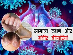 Health Symptoms: आपको अंदर से नुकसान पहुंचा रही हैं ये 5 बीमारियां, ऐसे करें मामूली लक्षणों की पहचान