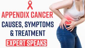 Appendix Cancer: Know What Are The Causes, Symptoms & Treatment Of Appendix Cancer, Expert Speaks, Watch Video