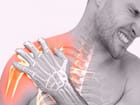 Frozen shoulder