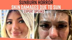 Skin Tanning: Sun Exposed Skin Got A Woman's Forehead Of Plastic, Says Sunscreen Was Not Applied, See What The Expert Has To Say, Watch Video