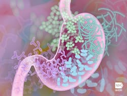 5 Inulin Rich Foods You Must Have For A Healthy Gut Microbiome