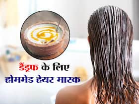 बालों में डैंड्रफ को जड़ से खत्म करते हैं ये 4 Homemade Mask जानें क्या है बनाने का तरीका
