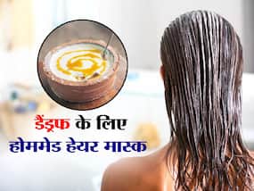बालों में डैंड्रफ को जड़ से खत्म करते हैं ये 4 Homemade Mask जानें क्या है बनाने का तरीका