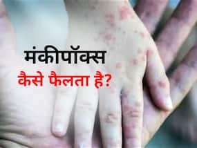 क्या पति से पत्नी और मां से बच्चे में फैल सकता है मंकीपॉक्स? एक्सपर्ट से जानें