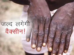 मंकीपॉक्स पॉजिटिव लोगों के संपर्क में आने वाले लोगों को लगेगी वैक्सीन! केंद्रीय मंत्री ने बताया जल्द शुरू होगा अभियान