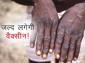 मंकीपॉक्स पॉजिटिव लोगों के संपर्क में आने वाले लोगों को लगेगी वैक्सीन! केंद्रीय मंत्री ने बताया जल्द शुरू होगा अभियान