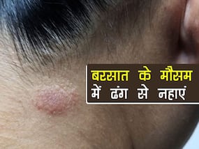 बरसात में सही से ना नहाना कर सकता है आपको बीमार, हो सकती हैं दाद खुजली समेत ये 5 परेशानियां