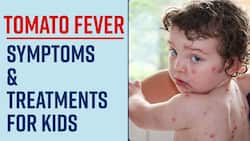 Tomato Fever: Rise In The Cases Of Tomato Flu, Spreads Mostly Among Children, Know The Symptoms & Treatment From The Expert, Watch Video