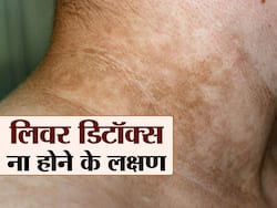 काली होती स्किन और गहरे रंग का मल लिवर डिटॉक्स (liver detox) ना होने के हैं संकेत, जानें 5 लक्षण