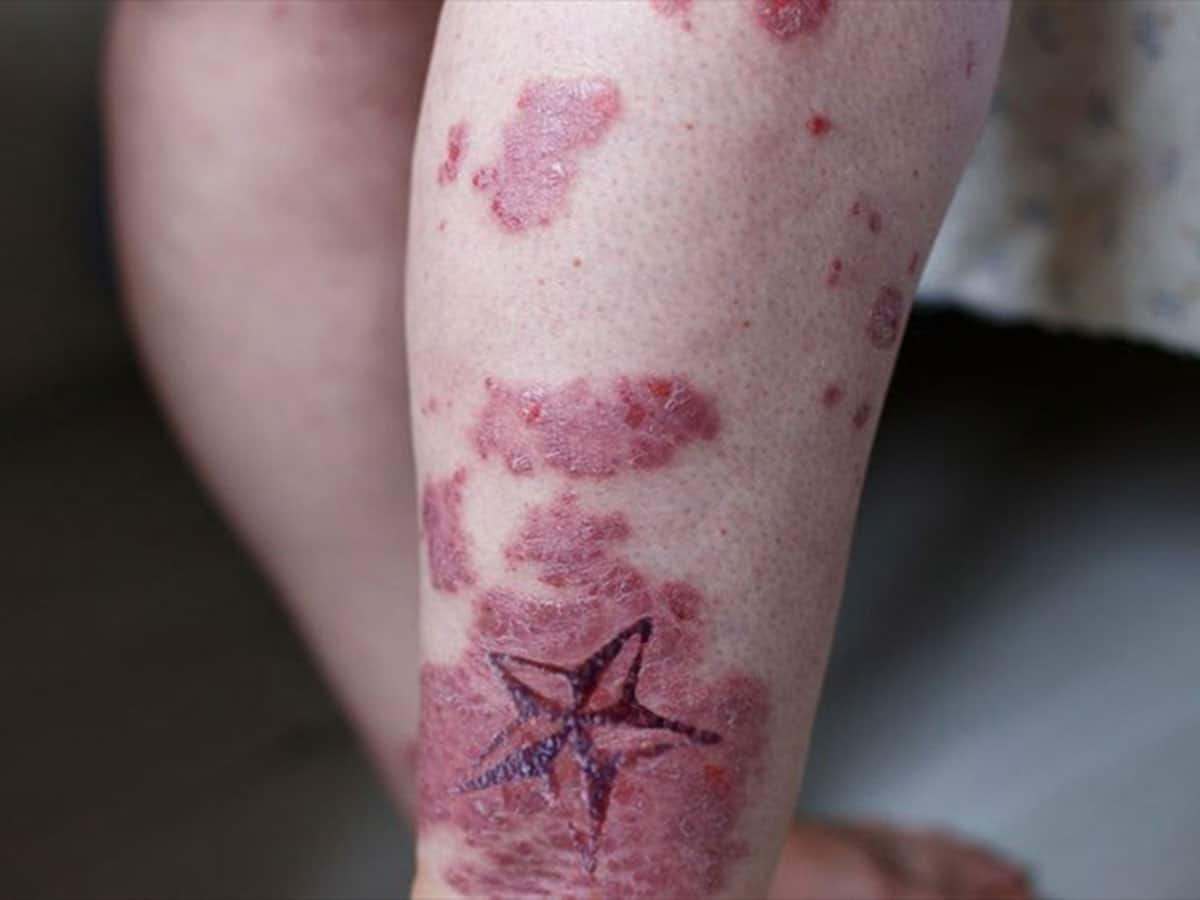 Hazardous Effects of Tattoo on Your Health  lifeberryscom