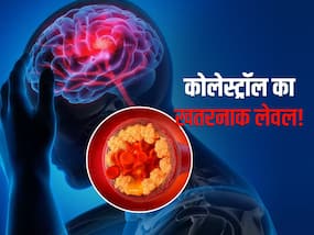 130 mg/dL से ज्यादा होने पर ये कोलेस्ट्रॉल बढ़ाता है स्ट्रोक का खतरा! जानें LDL और HDL का सेफ लेवल