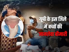 यूपी के इस जिले में अनजान बीमारी से हो रही बच्चों की मौत, WHO की टीम भी पहुंची पता लगाने