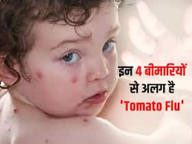 Tomato Flu in hindi : इन 4 घातक बीमारियों से बिल्कुल अलग है टोमाटो फ्लू! जानें किन राज्यों में फैली है ये बीमारी