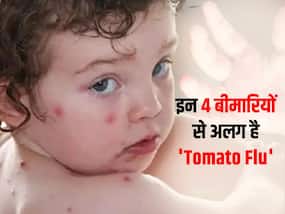 Tomato Flu in hindi : इन 4 घातक बीमारियों से बिल्कुल अलग है टोमाटो फ्लू! जानें किन राज्यों में फैली है ये बीमारी