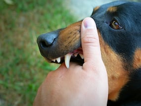 Rabies In Kerala: Fully Vaccinated Woman Dies of Complications, Govt Orders Probe