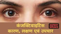 Conjunctivitis Treatment: कंजंक्टिवाइटिस से हैं परेशान तो डॉक्टर से जानें इसका आसान इलाज और इससे बचाव के तरीके, Watch Video