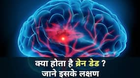 Brain Dead: ब्रेन डेड में मरीज़ के कौन-कौन से ऑर्गन काम करते हैं डॉक्टर से जानें पूरी जानकारी, Watch Video