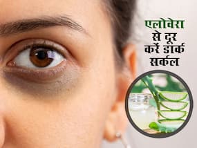 एलोवेरा से डार्क सर्कल कैसे हटाएं? जानें इस्तेमाल के 5 तरीके और फायदे
