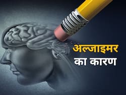 विटामिन की कमी समेत इन 5 कारणों से होता है अल्जाइमर, एक्सपर्ट से जानें