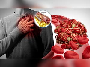 Healthy Heart: 9 Foods That Can Effectively Unclog Arteries