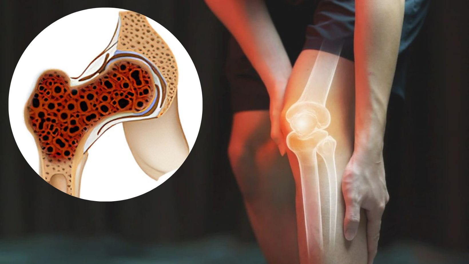 Bone & joint pain: breast cancer side effects