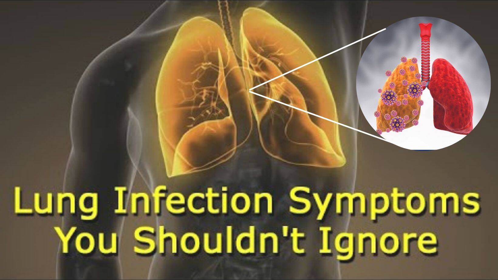 Lungs Infected With Pneumonia Lungs Infected With Pneumonia