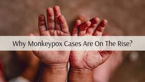 Why Monkeypox Cases Are On The Rise? Doctors Explain Potential Cause of The Resurgence