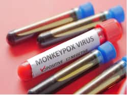 Monkeypox A.2 Strain: ICMR Identifies 3 Sub-Groups, Analyzes Genome Cases In India