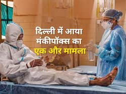 दिल्ली में आया मंकीपॉक्स का 9वां मामला, देश में संक्रमितों की कुल संख्या हुई 14