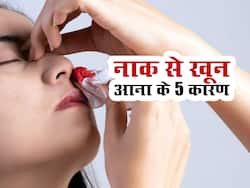 आम बात नहीं है नाक से खून आना, इन 5 गंभीर बीमारियों का हो सकता है संकेत
