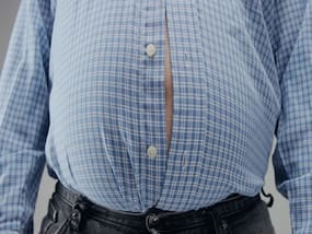 Is Obesity Linked To Cancer? Explains Gastroenterologist