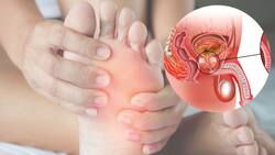 Prostate Cancer Symptoms: 3 Signs That Can Indicate Tumour Has Spread To Your Legs