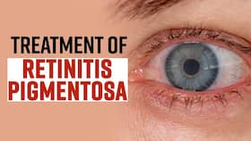 World Retina Day 2022: What Causes Retinitis Pigmentosa And How It is Treated?
