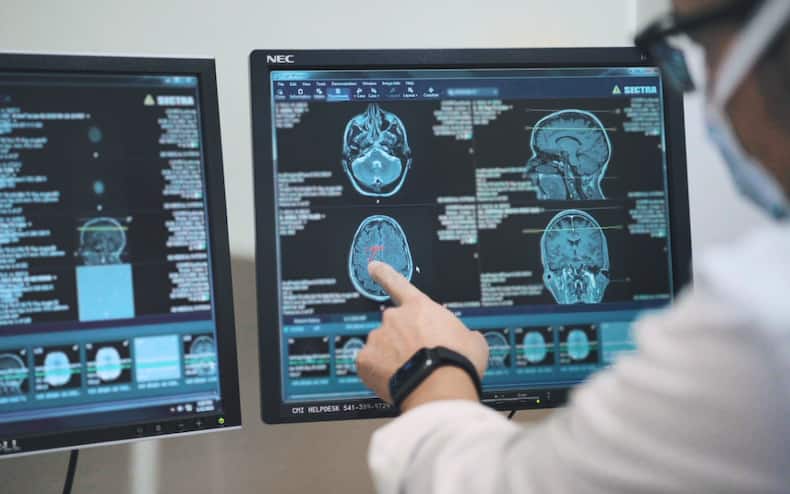 Brain Aneurysm: 9 Unusual Symptoms Of This Condition That Can Lead To Hemorrhagic Stroke