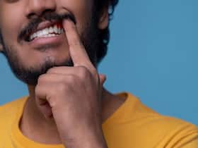 Bad Teeth And Its Impact Bad Teeth And Its Impact