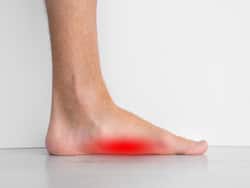 People With Flat Feet More Likely To Have Joint Problems, Arthritis, Low Back Pain