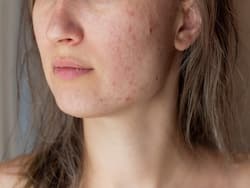 Many Underlying Health Conditions First Appear As Skin Problems: Skin Specialists