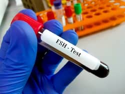 FSH Levels: Understand How This Hormone Indicates Your Fertility Potential