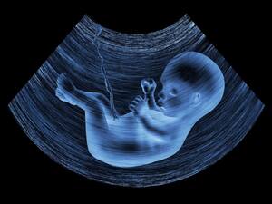 Babies Can Taste And Smell In The Womb: They Make Cry-Face When Their Mothers Eat Kale Babies Can Taste And Smell In The Womb: They Make Cry-Face When Their Mothers Eat Kale