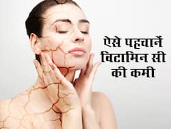 जोड़ों में दर्द और मसूड़ों से मवाद आने को ना करें नजरअंदाज, शरीर के ऐसे 5 लक्षण विटामिन सी जरूरत का है संकेत