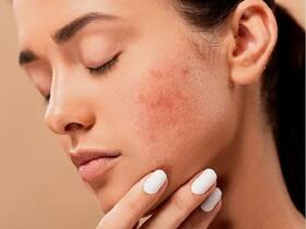 Skin care: दवा की जरूरत नहीं फिटकरी पाउडर से ही दूर हो जाएंगी सभी स्किन प्रॉब्लम्स, जानें इस्तेमाल का सही तरीका